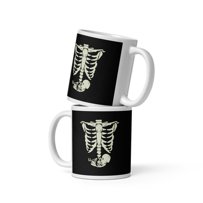 Pregnant X-Ray | White glossy mug